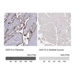 Atlas Antibodies Anti-GDF15 Antibody