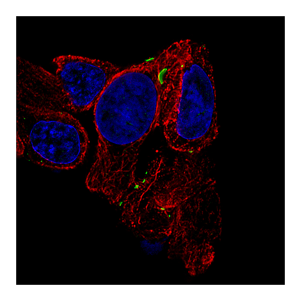 Atlas Antibodies Anti-GJB6 Antibody