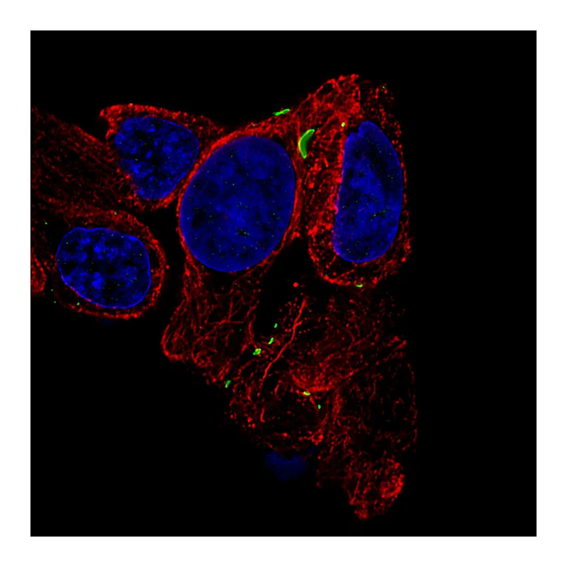 Atlas Antibodies Anti-GJB6 Antibody