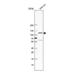 Atlas Antibodies Anti-GLI1 Antibody