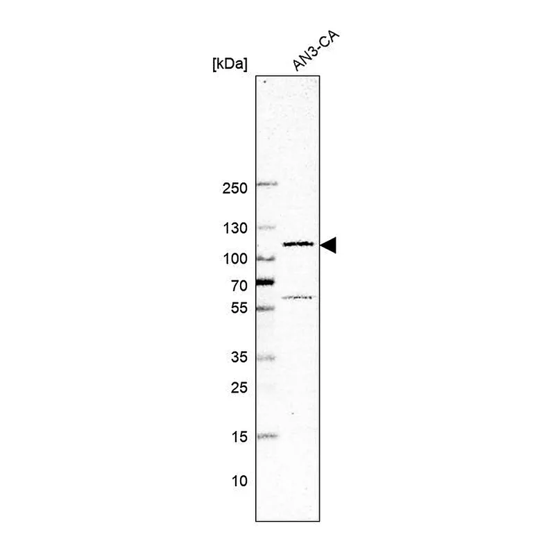 Atlas Antibodies Anti-GLI1 Antibody