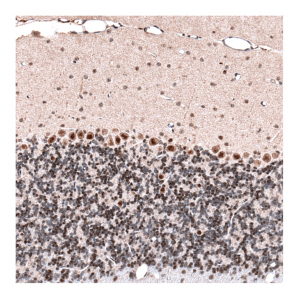 Atlas Antibodies Anti-GLI1 Antibody