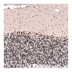 Atlas Antibodies Anti-GLI1 Antibody