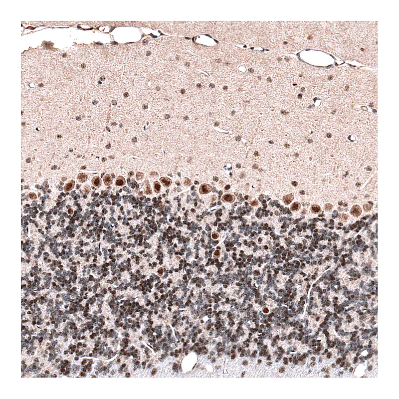 Atlas Antibodies Anti-GLI1 Antibody