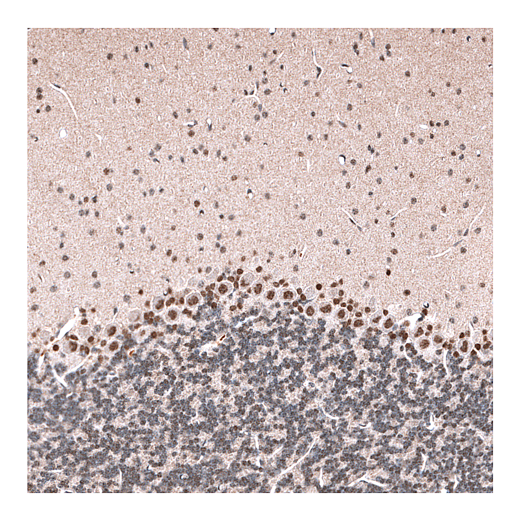 Atlas Antibodies Anti-GLI1 Antibody