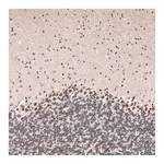 Atlas Antibodies Anti-GLI1 Antibody