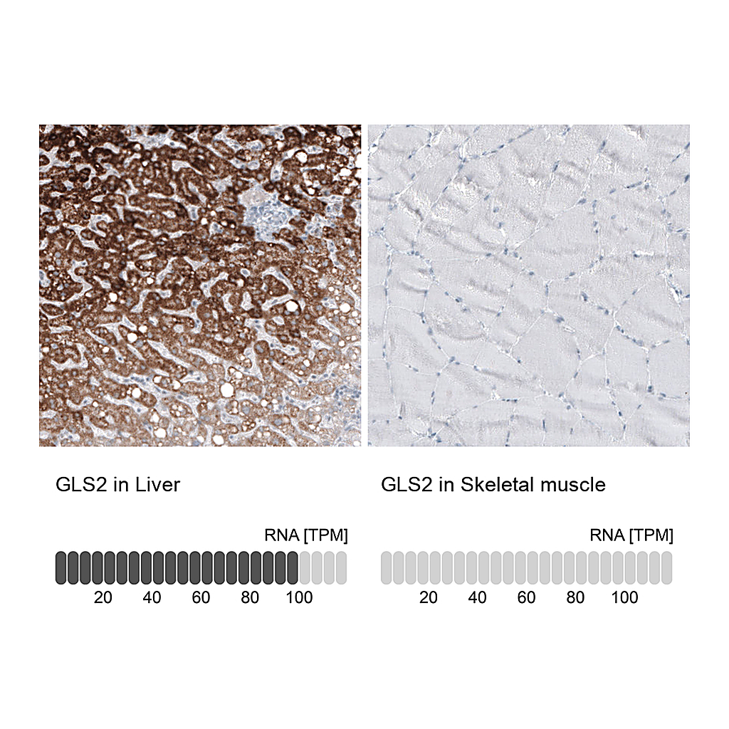 Atlas Antibodies Anti-GLS2 Antibody
