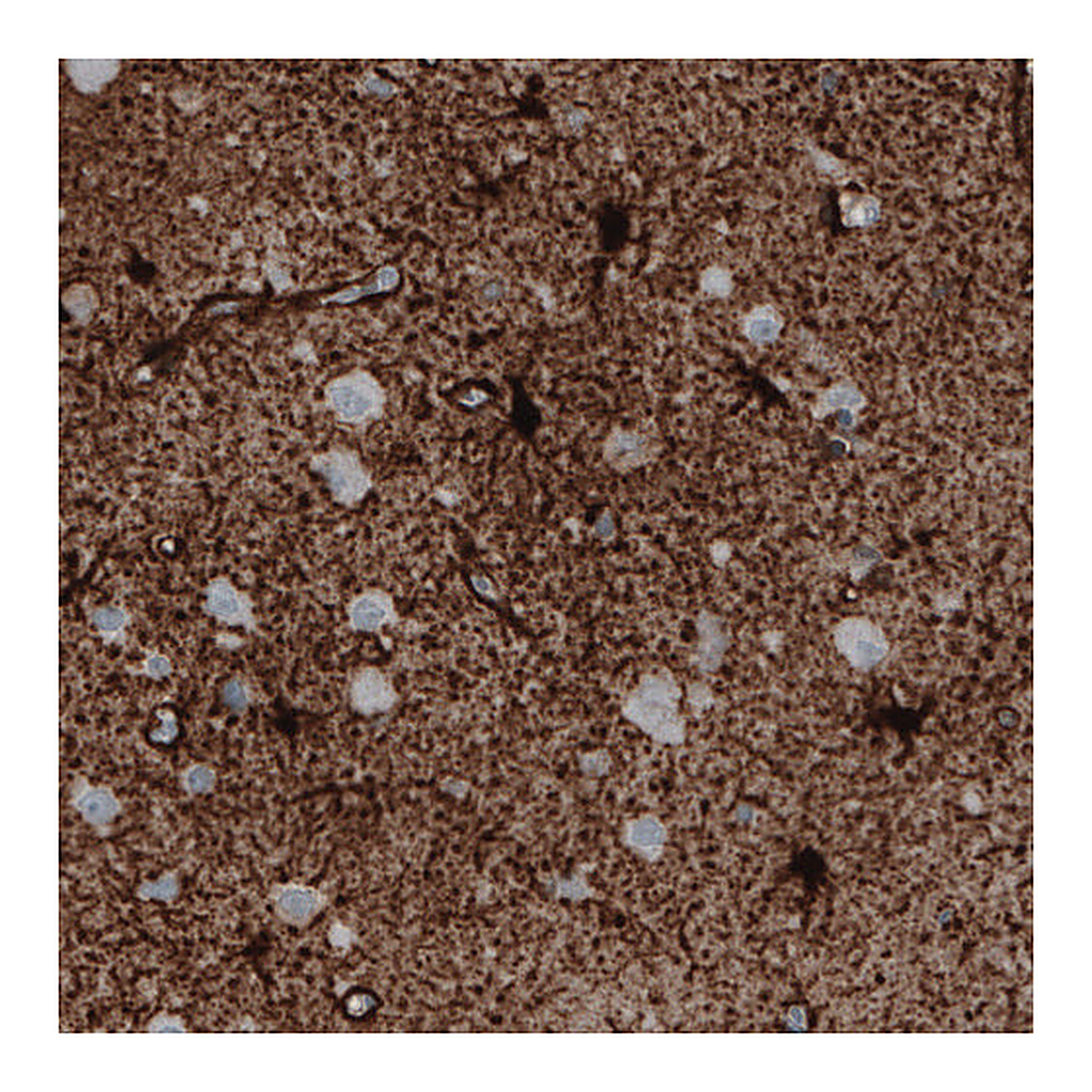 Atlas Antibodies Anti-GLUL Antibody
