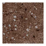 Atlas Antibodies Anti-GLUL Antibody