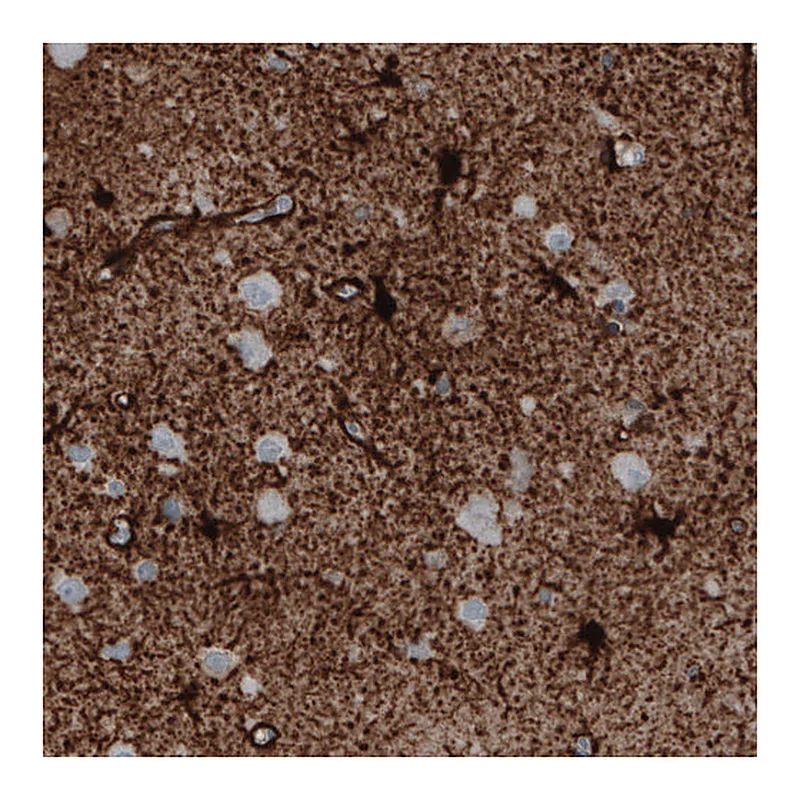 Atlas Antibodies Anti-GLUL Antibody