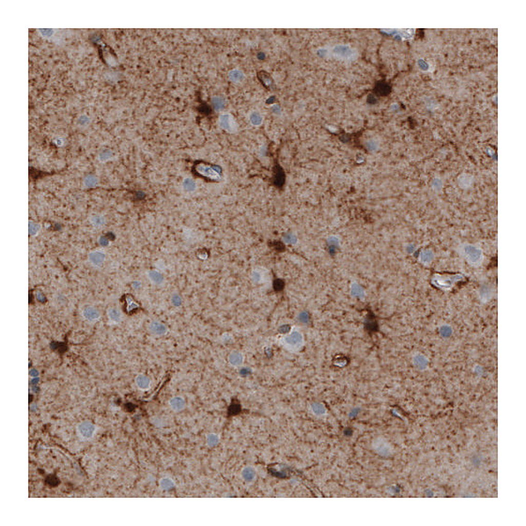Atlas Antibodies Anti-GLUL Antibody
