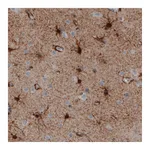 Atlas Antibodies Anti-GLUL Antibody
