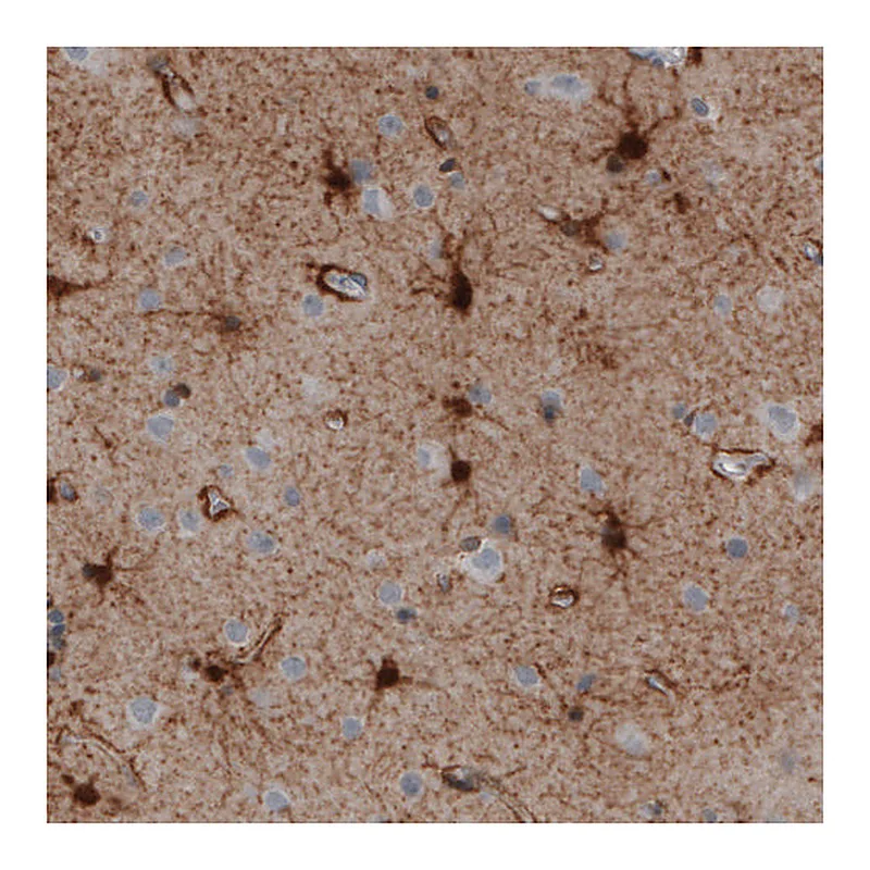 Atlas Antibodies Anti-GLUL Antibody