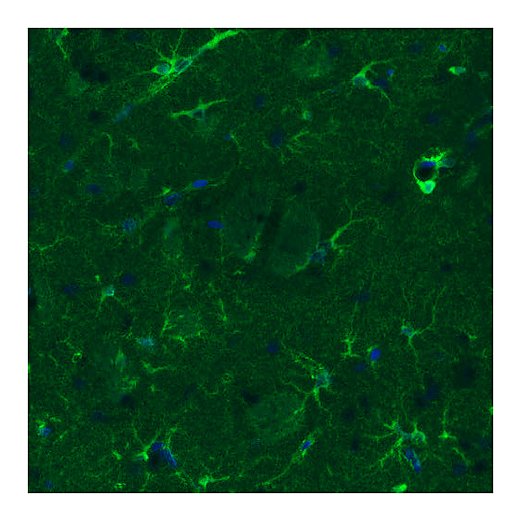 Atlas Antibodies Anti-GLUL Antibody