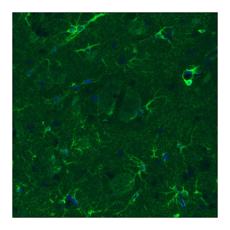 Atlas Antibodies Anti-GLUL Antibody