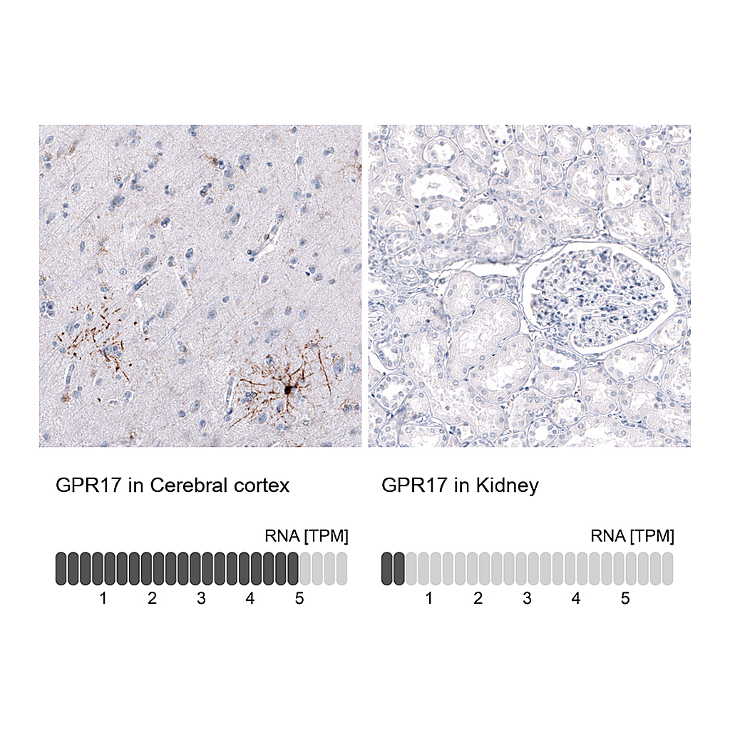 Atlas Antibodies Anti-GPR17 Antibody