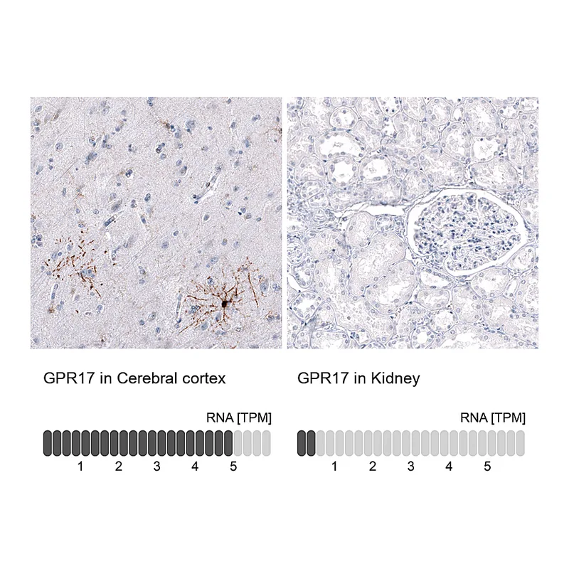 Atlas Antibodies Anti-GPR17 Antibody
