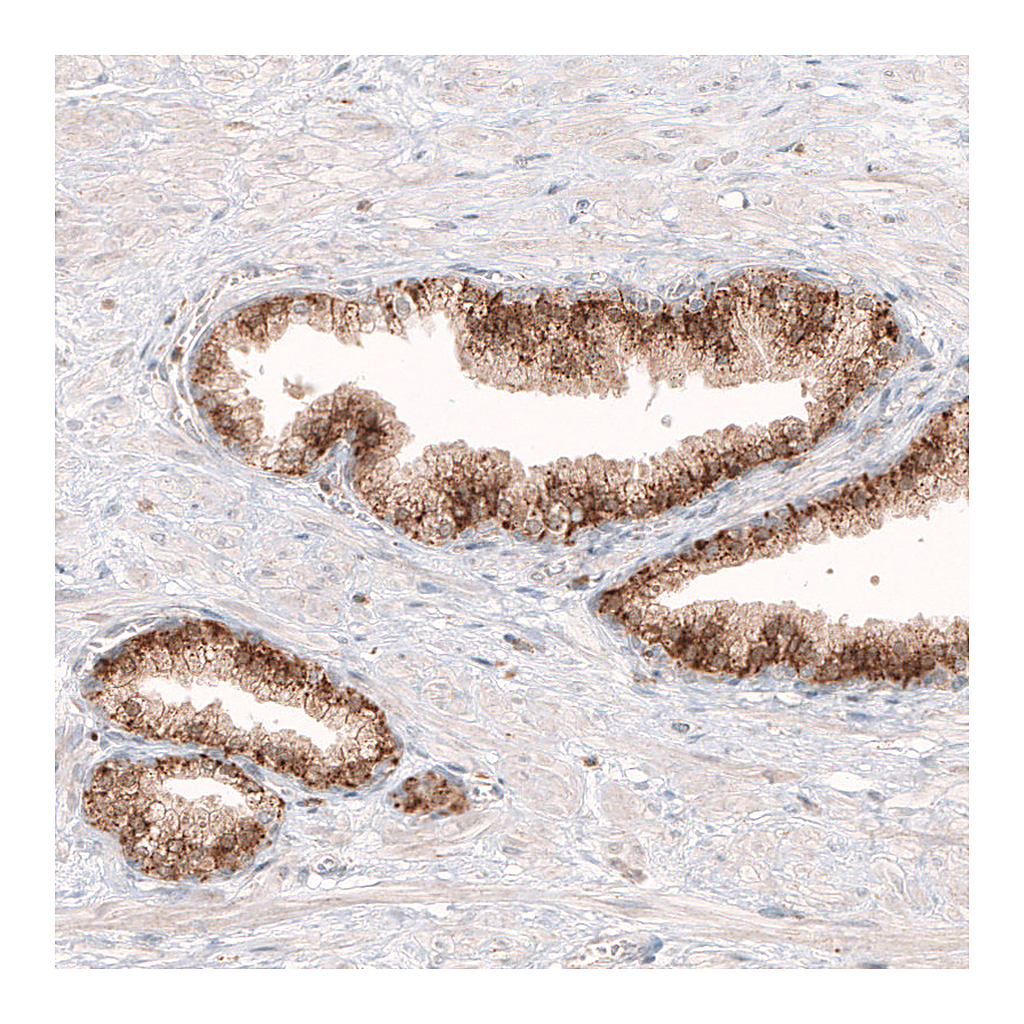 Atlas Antibodies Anti-GRN Antibody