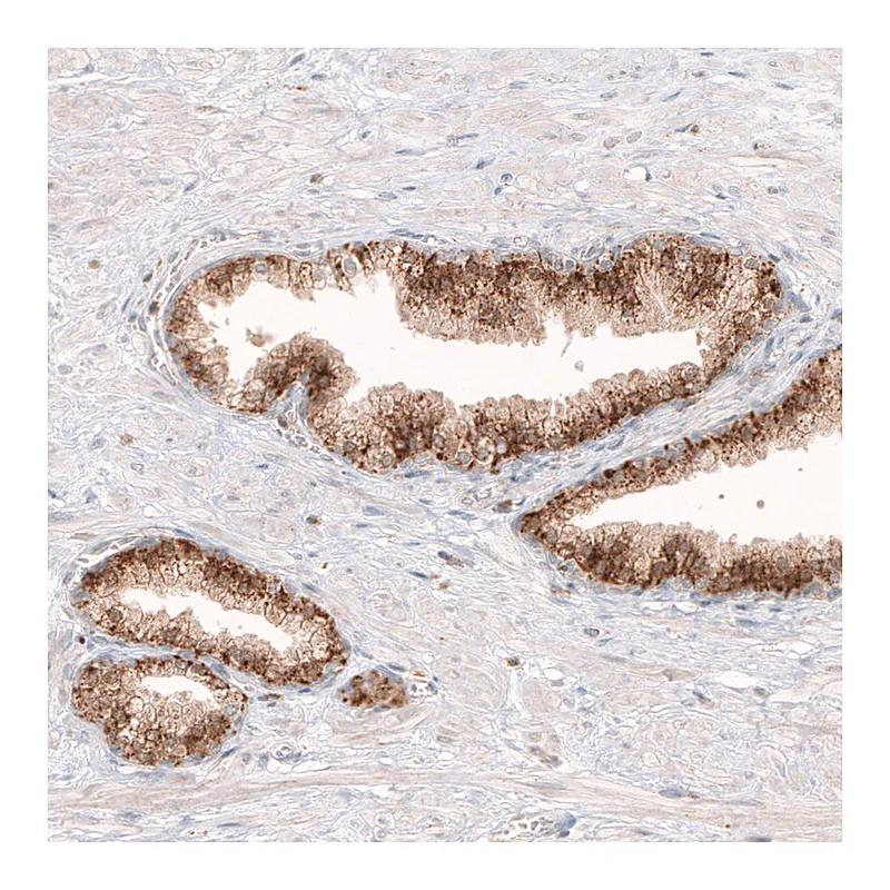 Atlas Antibodies Anti-GRN Antibody