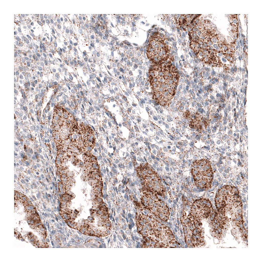 Atlas Antibodies Anti-GRN Antibody