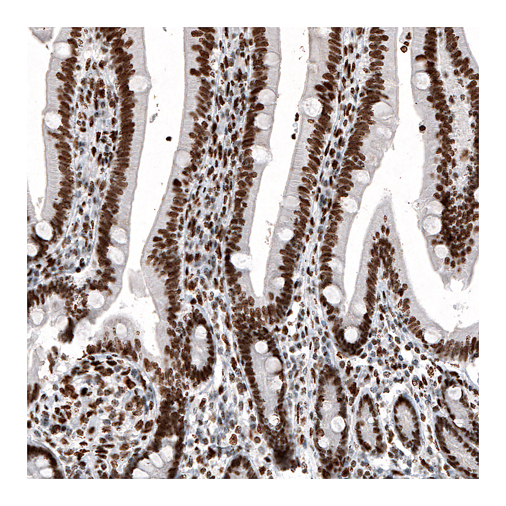 Atlas Antibodies Anti-H2AFY Antibody