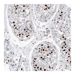 Atlas Antibodies Anti-H2AFY2 Antibody