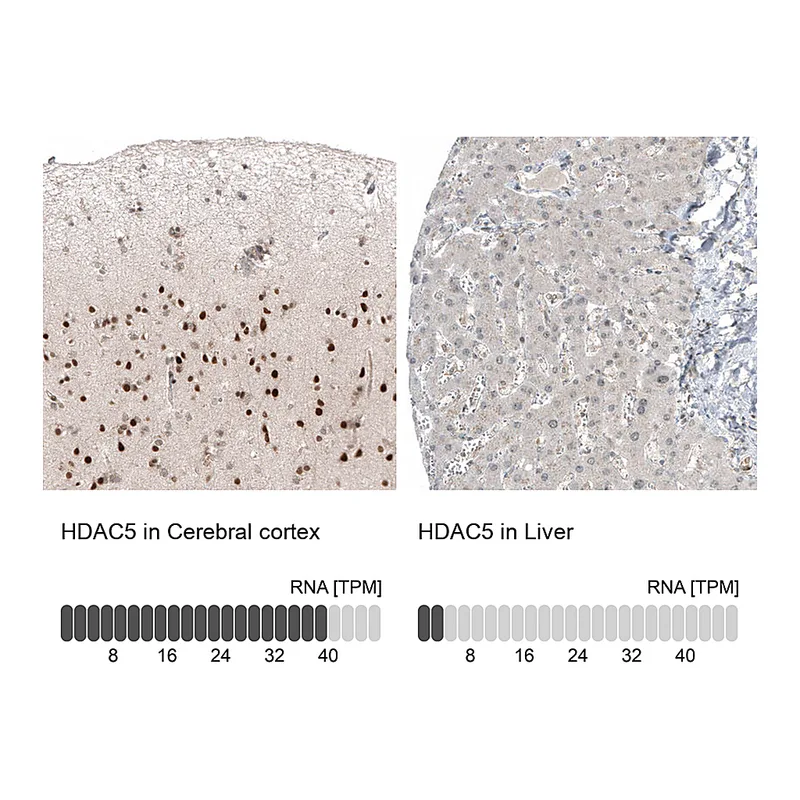 Atlas Antibodies Anti-HDAC5 Antibody