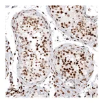 Atlas Antibodies Anti-HIST1H2AG Antibody