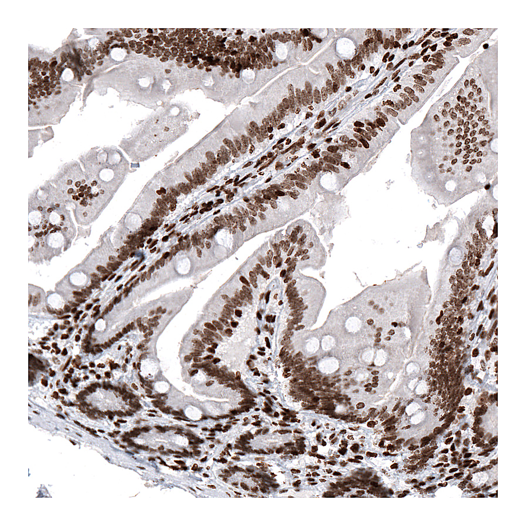 Atlas Antibodies Anti-HIST1H2AG Antibody