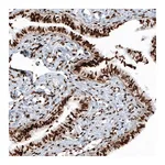 Atlas Antibodies Anti-HIST1H2BC Antibody