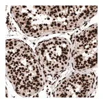 Atlas Antibodies Anti-HIST1H3A Antibody