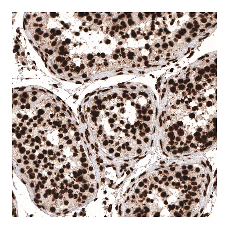 Atlas Antibodies Anti-HIST1H3A Antibody