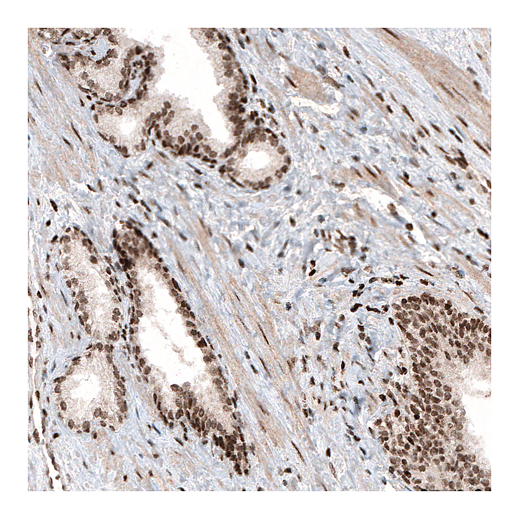 Atlas Antibodies Anti-HIST1H3A Antibody
