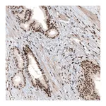 Atlas Antibodies Anti-HIST1H3A Antibody