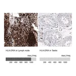 Atlas Antibodies Anti-HLA-DRA Antibody
