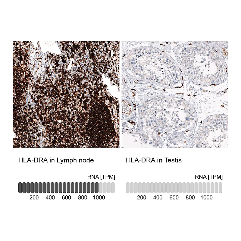 Atlas Antibodies Anti-HLA-DRA Antibody