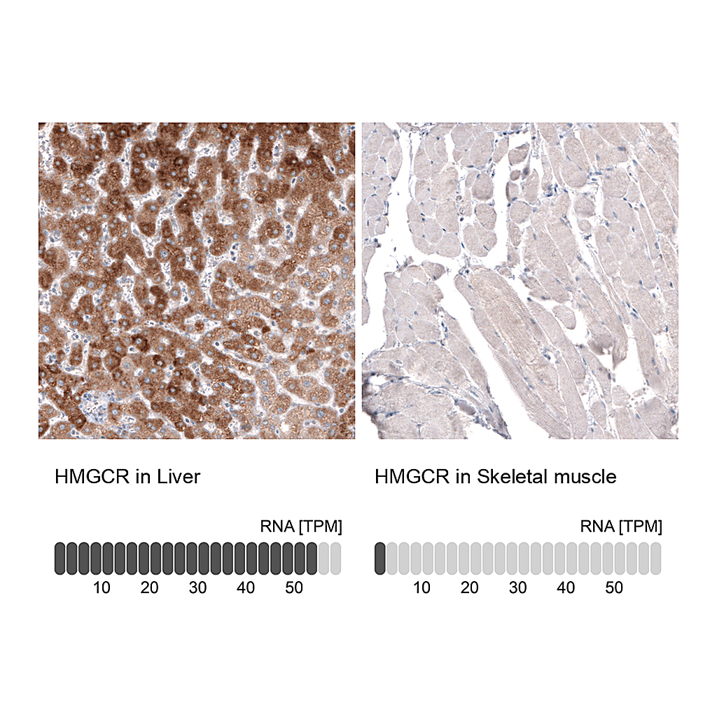 Atlas Antibodies Anti-HMGCR Antibody