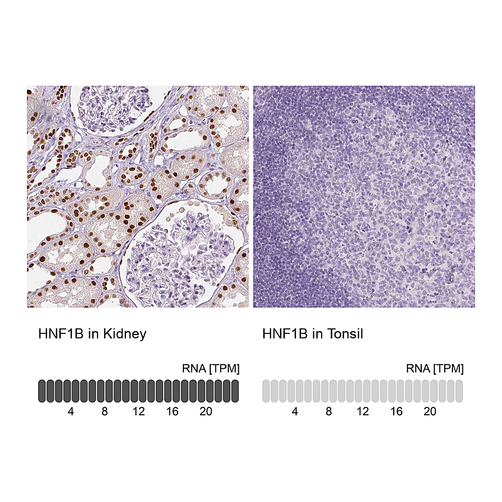 Atlas Antibodies Anti-HNF1B Antibody