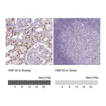 Atlas Antibodies Anti-HNF1B Antibody