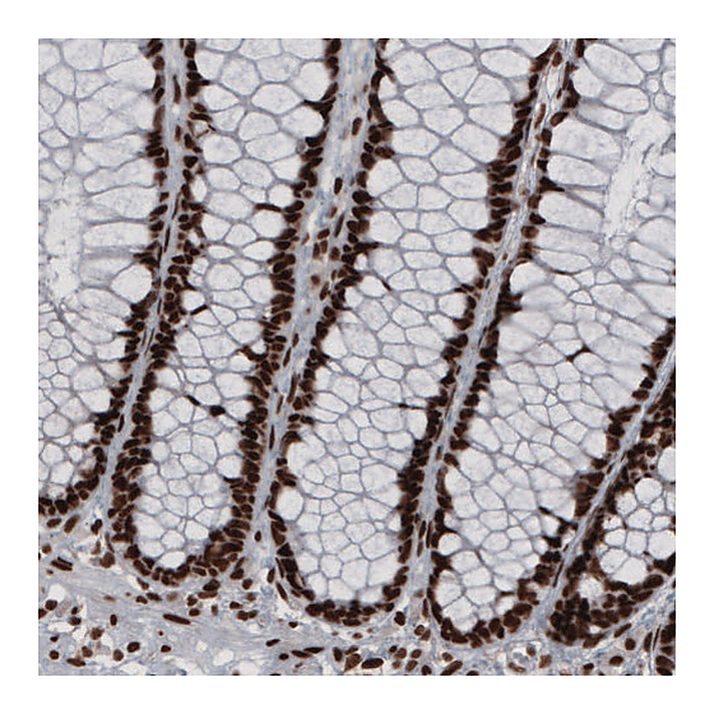 Atlas Antibodies Anti-HNRNPC Antibody