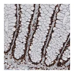 Atlas Antibodies Anti-HNRNPC Antibody
