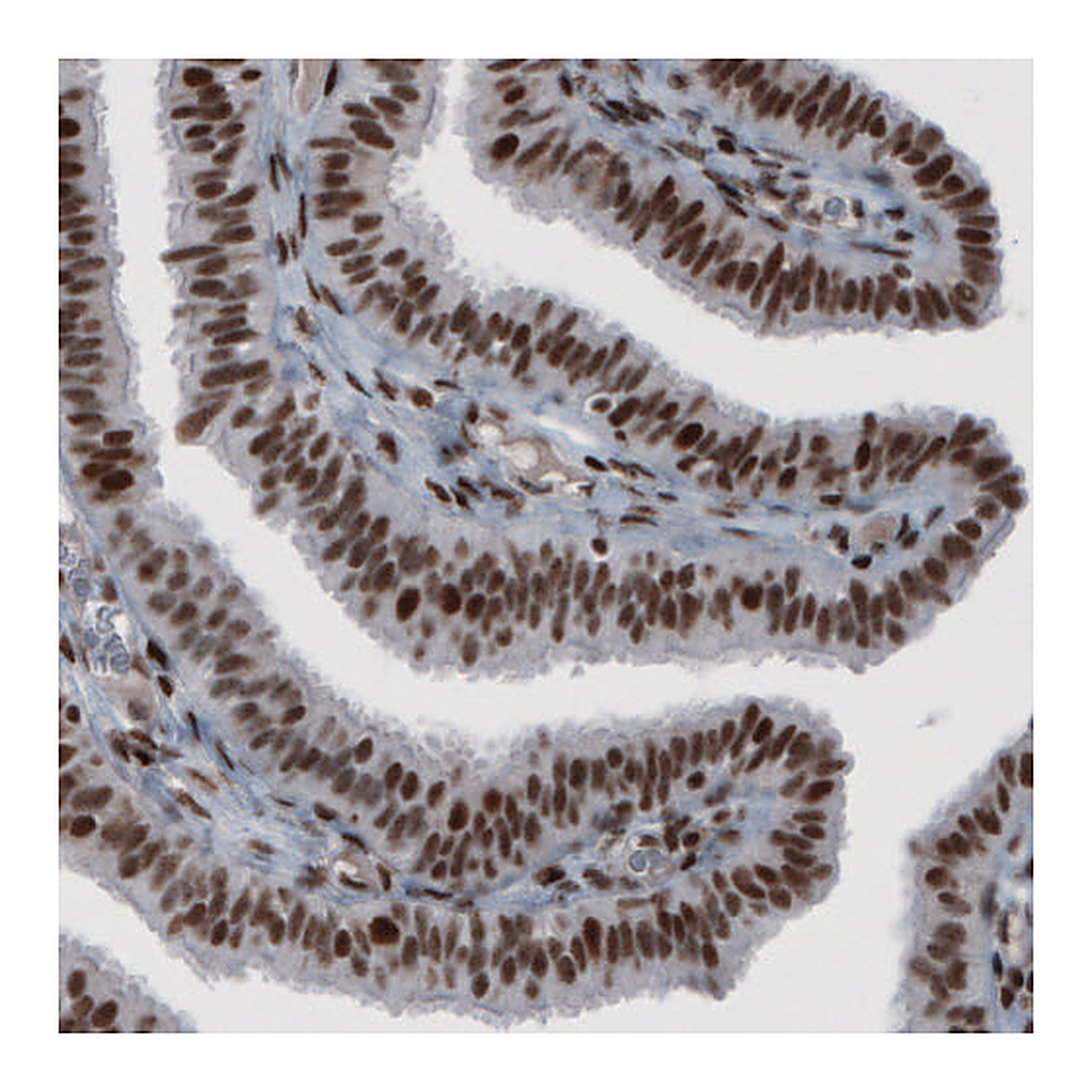 Atlas Antibodies Anti-HNRNPC Antibody