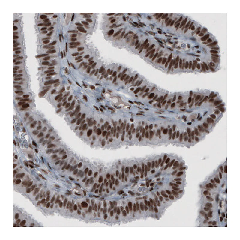 Atlas Antibodies Anti-HNRNPC Antibody