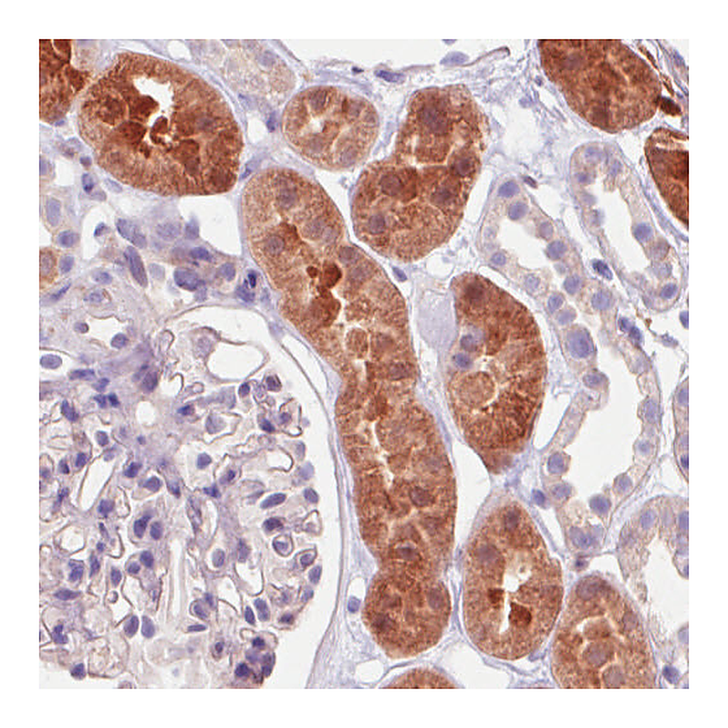 Atlas Antibodies Anti-IDH1 Antibody