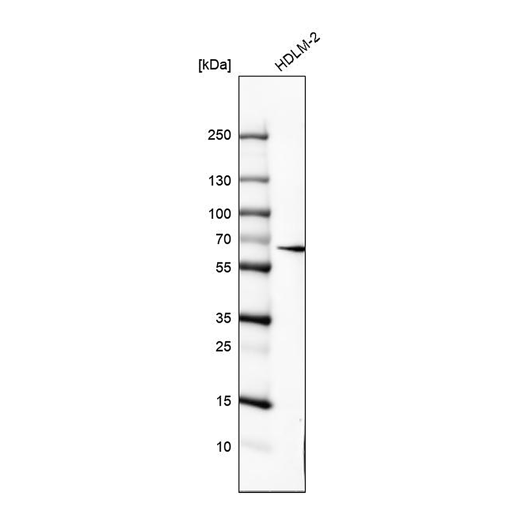 Atlas Antibodies Anti-IL10RA Antibody