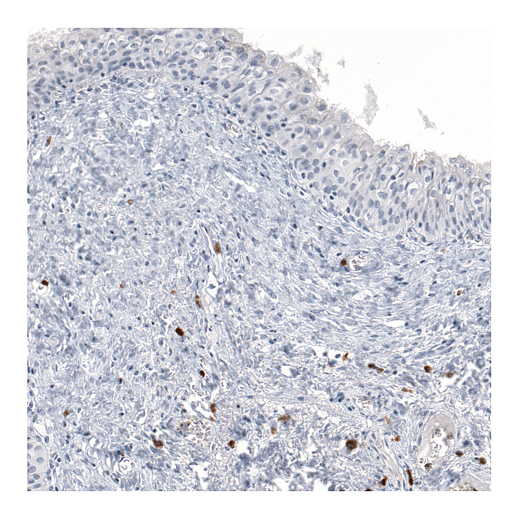 Atlas Antibodies Anti-IL17A Antibody