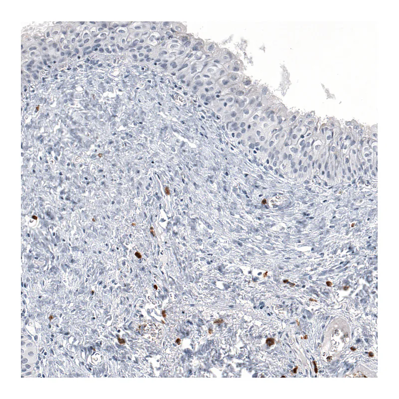 Atlas Antibodies Anti-IL17A Antibody