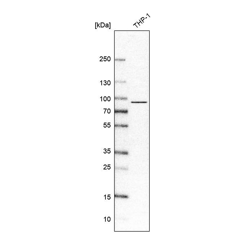 Atlas Antibodies Anti-IL17RA Antibody