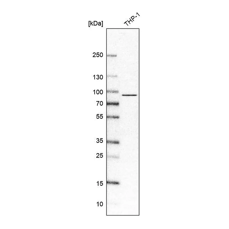 Atlas Antibodies Anti-IL17RA Antibody