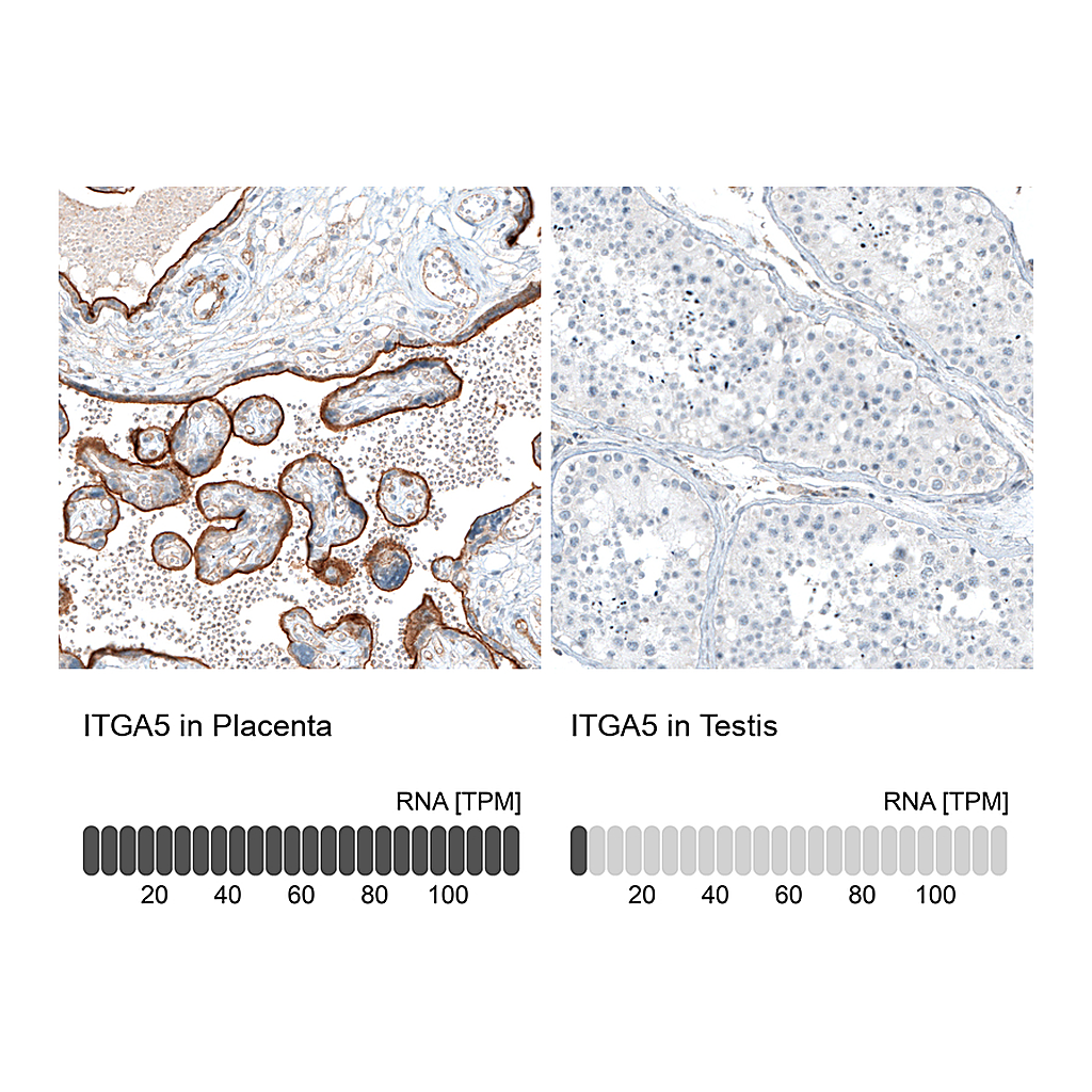 Atlas Antibodies Anti-ITGA5 Antibody
